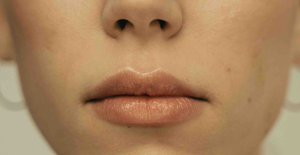 Close-up of natural lip filler showing soft volume and defined lip border in Cumming GA