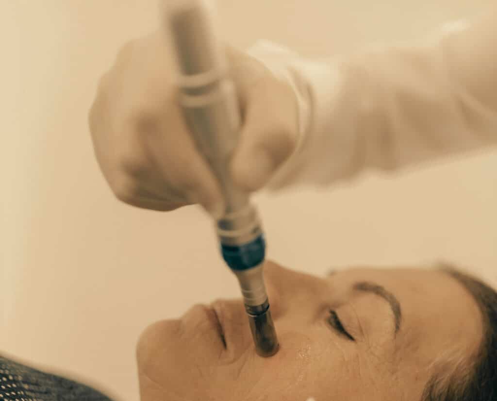 Esthetician applying serum during microneedling treatment on female client at med spa in Cumming GA