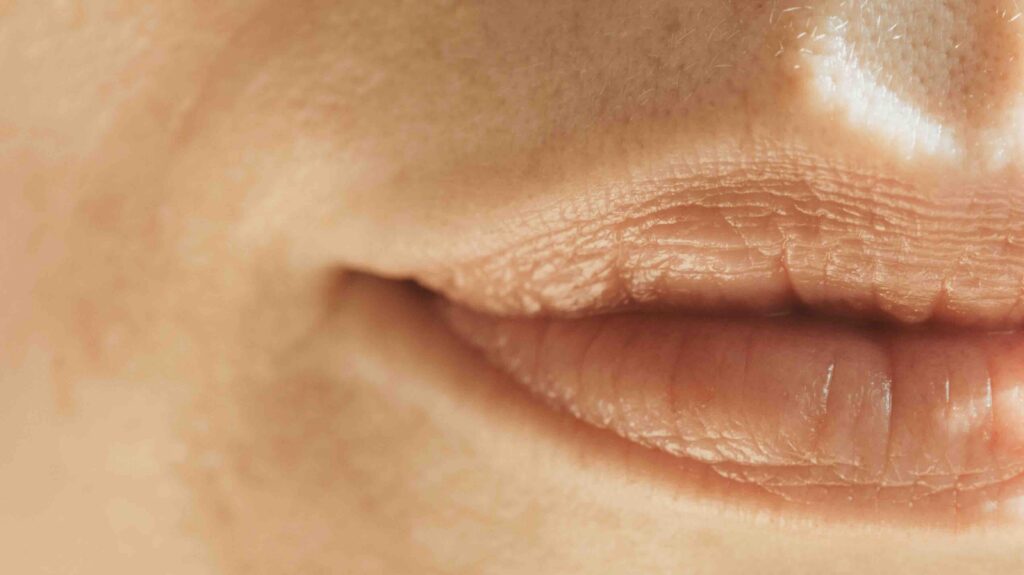 Natural-looking lip filler results with soft definition in Cumming GA